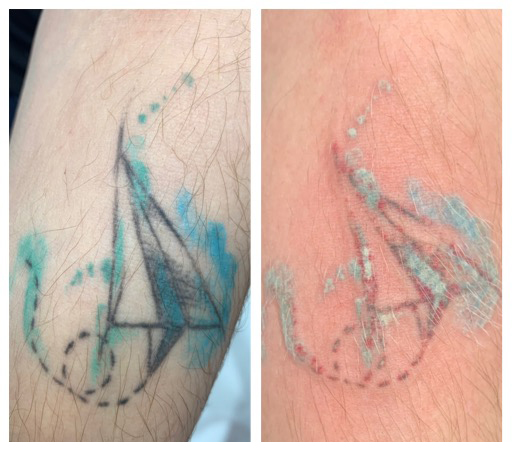 Клинический случай 3