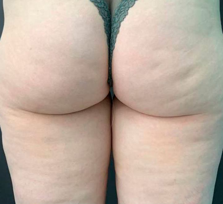 Virtue, результат