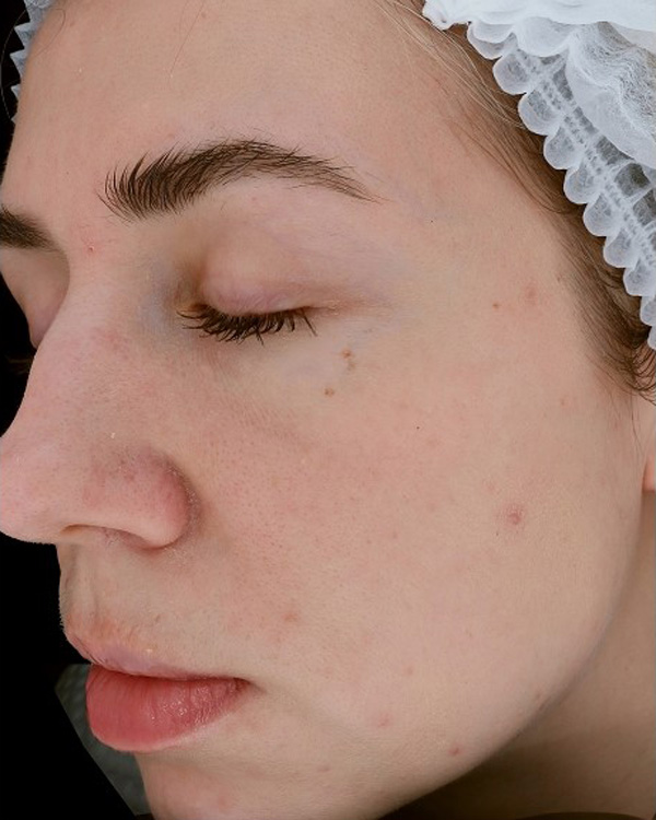 Calecim Professional Serum