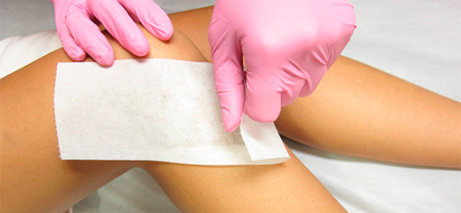 Биоэпиляция