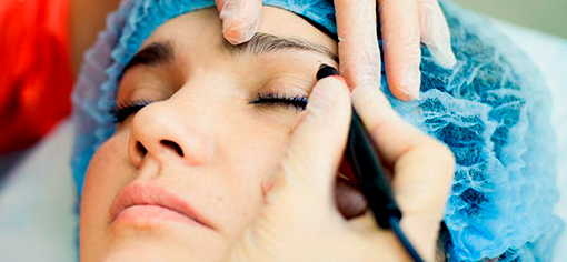 Электроэпиляция