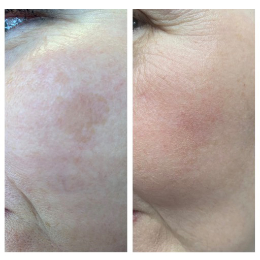 Клинический случай 2