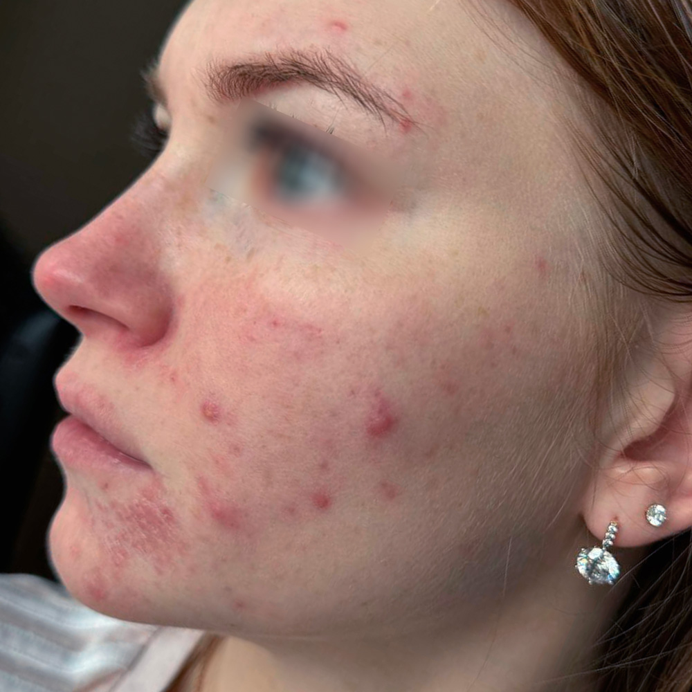 Ixtron Sprint Angel, фото до