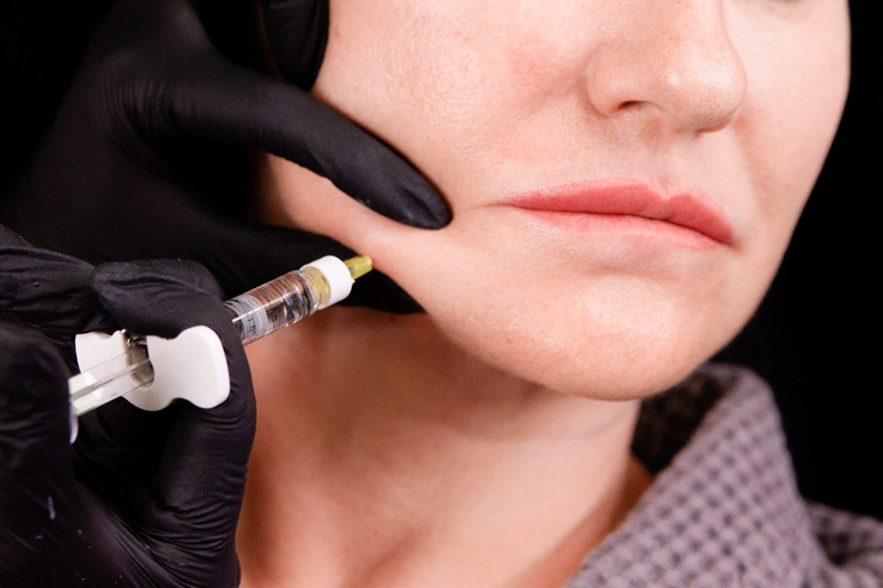 Протокол процедуры Peach Peel PRO и Colibriderm Hydro