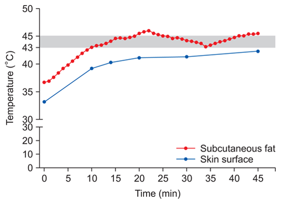 Новейшая технология ISRF подачи энергии