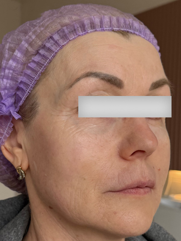 Light Fit NMN и Light Fit PDRN+