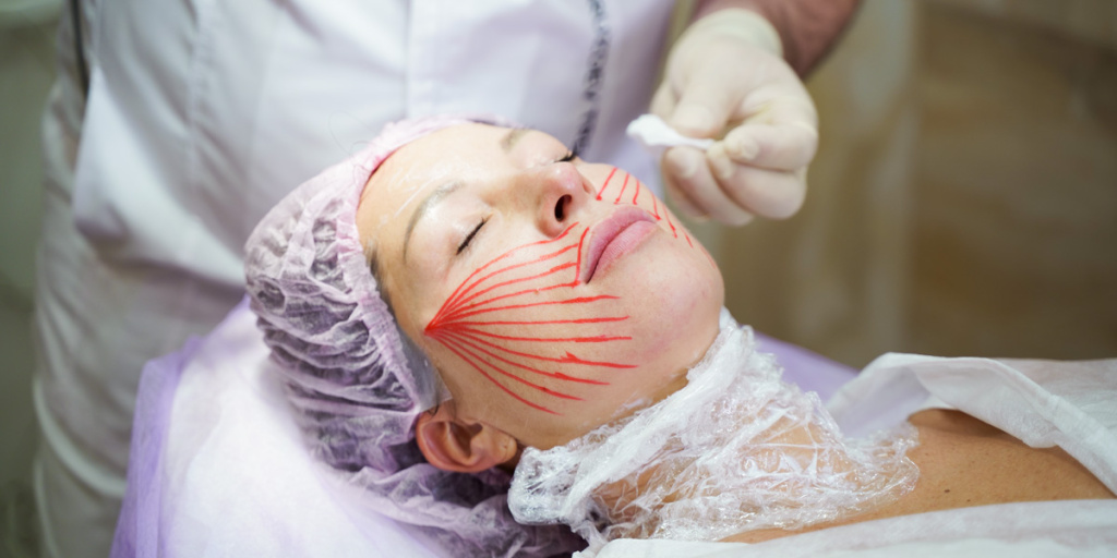 Онлайн сессия Техники нитевой имплантации