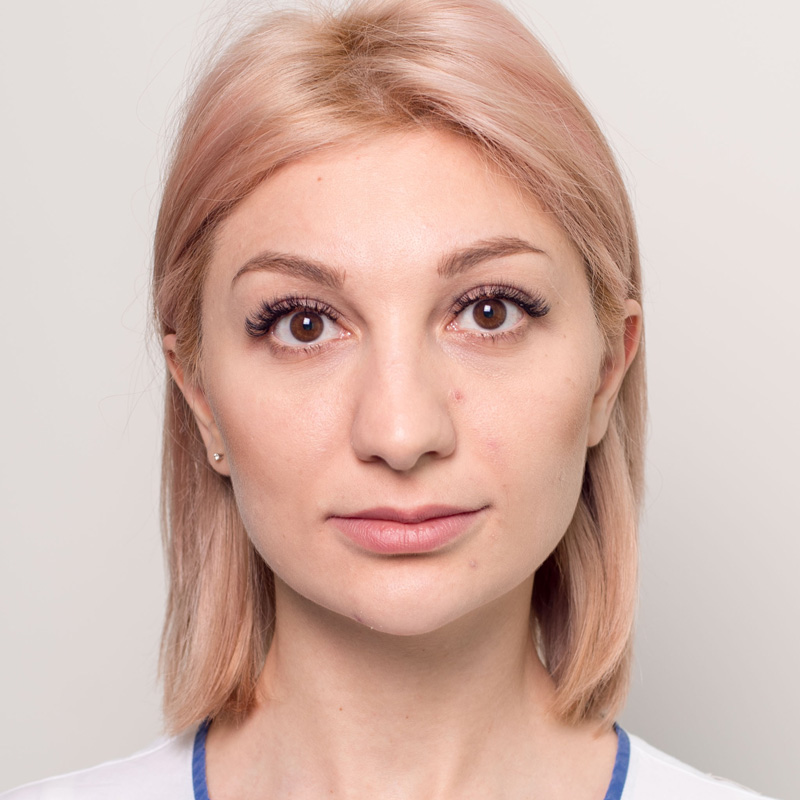 Алла, 32 года. Фото после