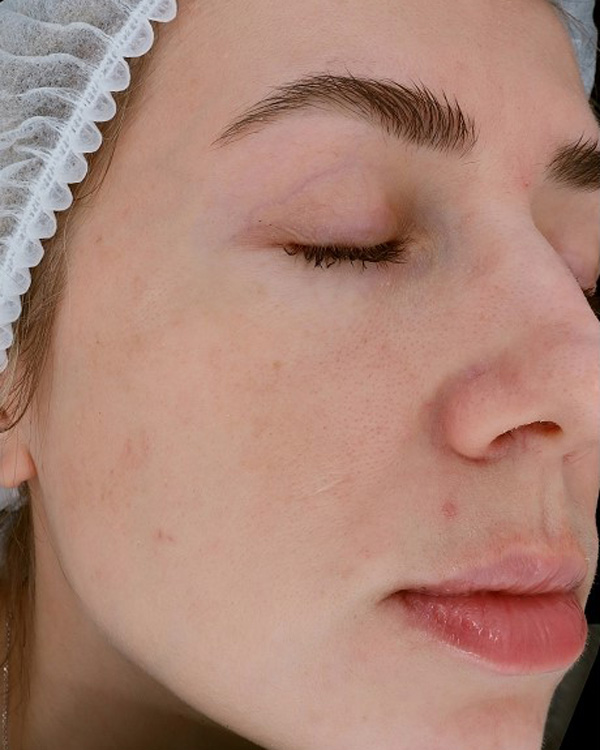 Calecim Professional Serum
