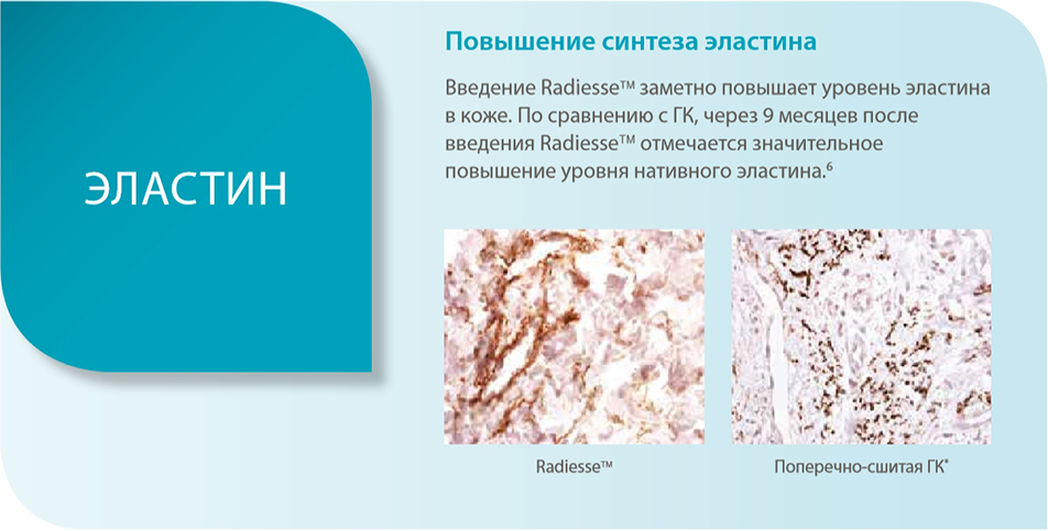 Эластин