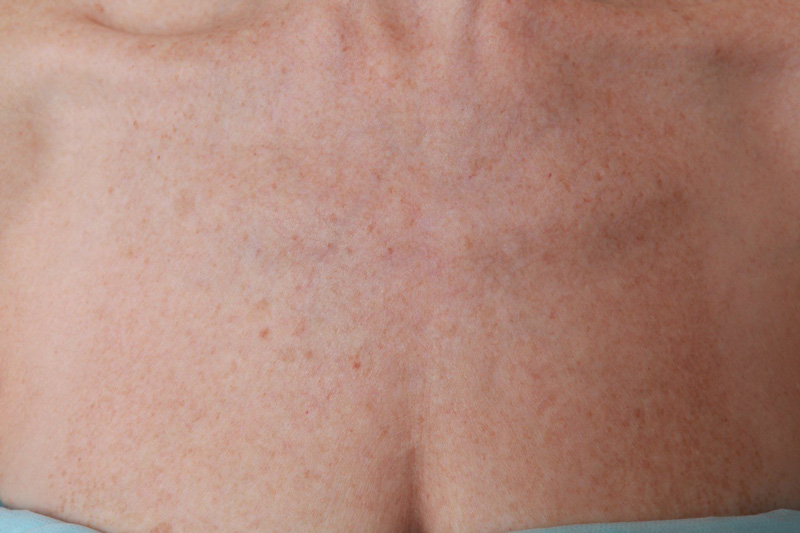 Bio-expander