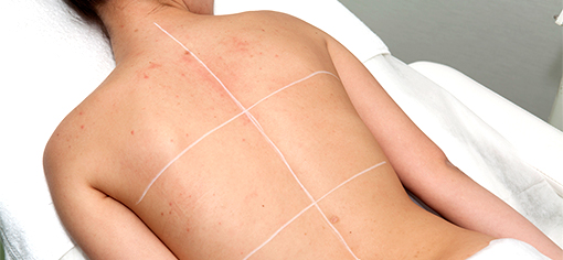 Easy Phytic Peel