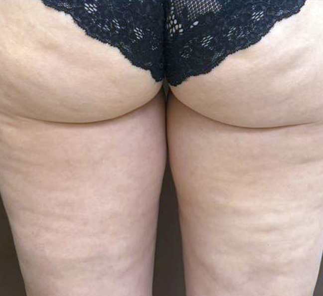 Virtue, результат