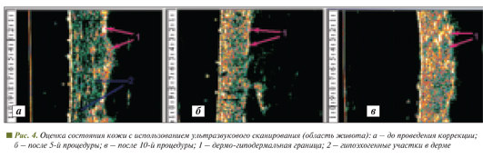 Оценка состояния кожи