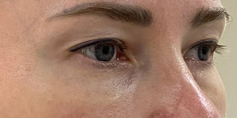 фракционный термолиз на аппарате CAPELLO CO2 Re:Flex, фото до