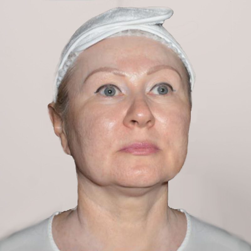 Наталья, 54 года. Фото до