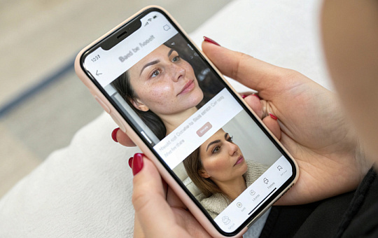 Рекламе с приемом «до/после» доверяют больше, чем репутации бренда