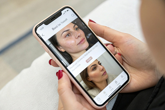 Рекламе с приемом «до/после» доверяют больше, чем репутации бренда