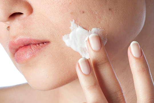 Лечение акне взрослых (Acne tarda) препаратами от Skintellectual Solutions