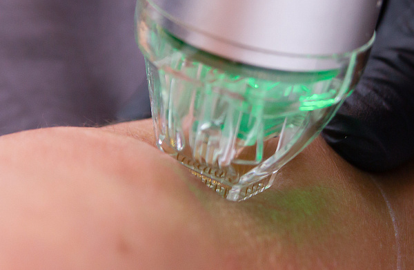 Ozempic body: клинический опыт