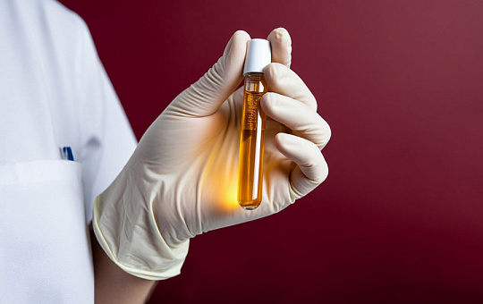 Аутологичная плазма: честный взгляд практика