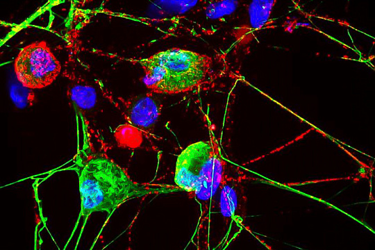 Клеточные протеасомы связали с работой нервных клеток в коже