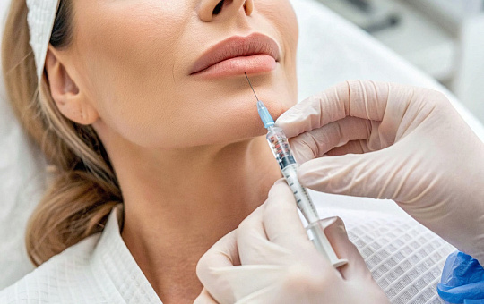 6 причин, почему может мигрировать филлер в губах