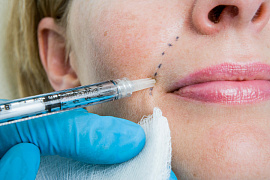 Аллергия – «фобия» иммунной системы