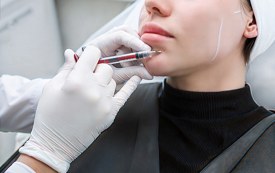 Экспресс-омоложение лица по лифтинговым точкам