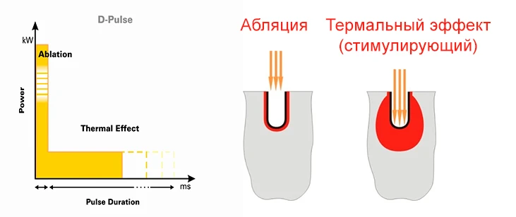 Форма импульса D-Pulse™ Форма импульса D-Pulse™