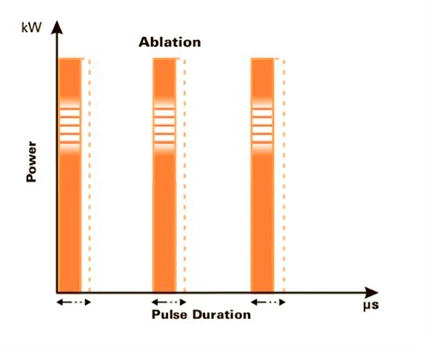 Форма импульса U-Pulse™ Форма импульса U-Pulse™