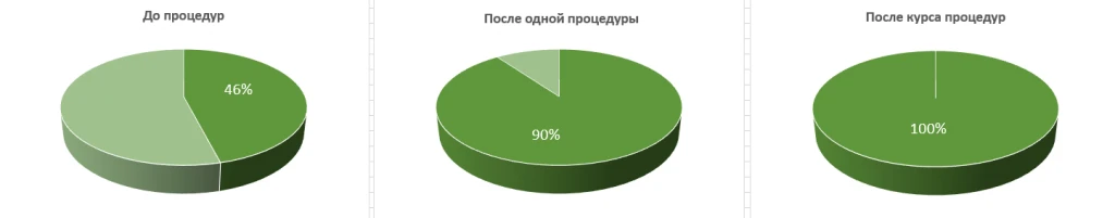 Повышенная сальность Аппарат INUS. Повышенная сальность